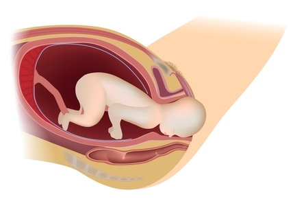 gimimo-etapai-stumimas