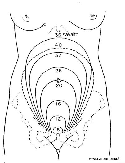 gimdos-dugno-aukstis1
