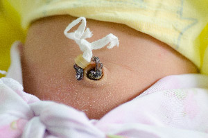 Naujagimio virkštelė